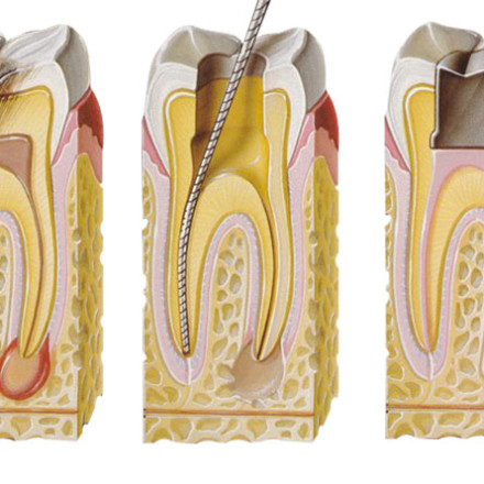 Endodonzia