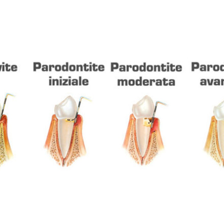 Parodontologia